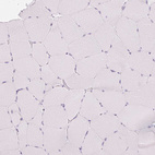 Immunohistochemical staining of human skeletal muscle shows no positivity in myocytes as expected.