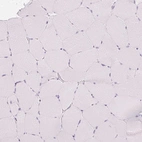 Immunohistochemical staining of human skeletal muscle shows no positivity in myocytes as expected.