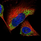 Immunofluorescent staining of human cell line U-251 MG shows localization to vesicles.