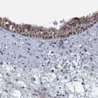 Anti-ZNF677 Antibody