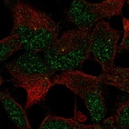 Immunofluorescent staining of human cell line AF22 shows localization to nucleus & centrosome.