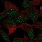 Immunofluorescent staining of human cell line AF22 shows localization to nucleus & centrosome.