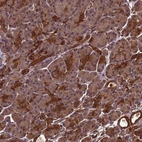 Immunohistochemical staining of human pancreas shows moderate granular cytoplasmic positivity in exocrine glandular cells.