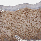 Immunohistochemical staining of human cervix shows strong cytoplasmic positivity in squamous epithelial cells.