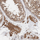 Immunohistochemical staining of human testis shows strong cytoplasmic positivity in Leydig cells and cells in seminiferous ducts.