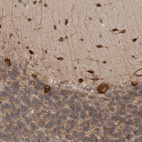 Immunohistochemical staining of human cerebellum shows strong cytoplasmic positivity in Purkinje cells and cells in molecular layer.
