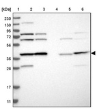 Lane 1: Marker [kDa] 230, 130, 95, 72, 56, 36, 28, 17, 11_br/_Lane 2: Human cell line RT-4_br/_Lane 3: Human cell line U-251MG sp_br/_Lane 4: Human plasma (IgG/HSA depleted)_br/_Lane 5: Human liver tissue_br/_Lane 6: Human tonsil tissue