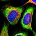 Immunofluorescent staining of human cell line U-2 OS shows localization to cytosol.