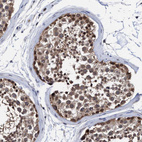 Anti-PSMD12 Antibody