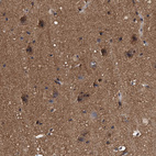 Immunohistochemical staining of human cerebral cortex shows strong cytoplasmic positivity in neurons.