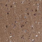 Anti-PSMD12 Antibody