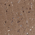 Immunohistochemical staining of human cerebral cortex shows strong cytoplasmic positivity in neurons.