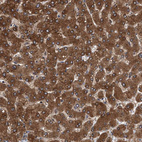 Anti-PSMD12 Antibody