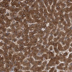 Immunohistochemical staining of human liver shows strong cytoplasmic positivity in hepatocytes.