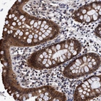 Immunohistochemical staining of human rectum shows strong cytoplasmic positivity in glandular cells.