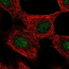 Immunofluorescent staining of human cell line A549 shows localization to nucleus.