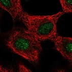 Immunofluorescent staining of human cell line A549 shows localization to nucleus.