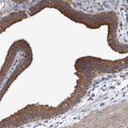 Anti-MRPL38 Antibody
