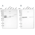 Western blot analysis using Anti-MRPL38 antibody HPA023135 (A) shows similar pattern to independent antibody HPA023054 (B).