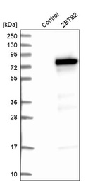Western blot analysis in control (vector only transfected HEK293T lysate) and ZBTB2 over-expression lysate (Co-expressed with a C-terminal myc-DDK tag (~3.1 kDa) in mammalian HEK293T cells, LY412230).