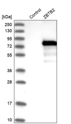 Western blot analysis in control (vector only transfected HEK293T lysate) and ZBTB2 over-expression lysate (Co-expressed with a C-terminal myc-DDK tag (~3.1 kDa) in mammalian HEK293T cells, LY412230).