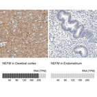 Anti-NEFM Antibody