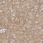 Immunohistochemical staining of human cerebral cortex shows strong positivity in neuronal processes.