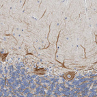 Immunohistochemical staining of human cerebellum shows strong positivity in neuronal processes from Purkinje cells.