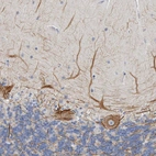 Immunohistochemical staining of human cerebellum shows strong positivity in neuronal processes from Purkinje cells.