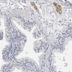 Anti-NEFM Antibody