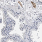 Immunohistochemical staining of human prostate shows strong positivity in peripheral nerve.