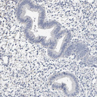 Anti-NEFM Antibody