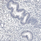 Immunohistochemical staining of human endometrium shows no positivity in glandular cells as expected.