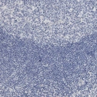 Immunohistochemical staining of human tonsil shows no positivity in lymphoid cells as expected.
