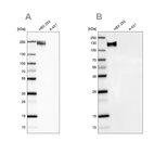 Anti-NEFM Antibody