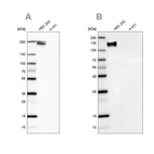 Western blot analysis using Anti-NEFM antibody HPA023138 (A) shows similar pattern to independent antibody HPA022845 (B).