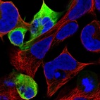 Immunofluorescent staining of human cell line HEK 293 shows localization to intermediate filaments.