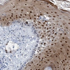 Immunohistochemical staining of human skin shows strong nuclear positivity in squamous epithelial cells.
