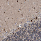 Immunohistochemical staining of human cerebellum shows strong nuclear positivity in Purkinje and glial cells.