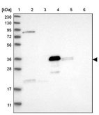 Lane 1: Marker [kDa] 230, 130, 95, 72, 56, 36, 28, 17, 11_br/_Lane 2: Human cell line RT-4_br/_Lane 3: Human cell line U-251MG sp_br/_Lane 4: Human plasma (IgG/HSA depleted)_br/_Lane 5: Human liver tissue_br/_Lane 6: Human tonsil tissue