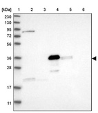 Anti-DDHD2 Antibody