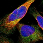 Immunofluorescent staining of human cell line U-2 OS shows localization to cytosol.