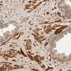 Immunohistochemical staining of human prostate shows strong cytoplasmic positivity in smooth muscle cells.
