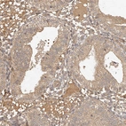 Immunohistochemical staining of human endometrium shows weak cytoplasmic positivity in glandular cells.
