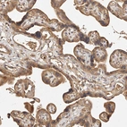 Immunohistochemical staining of human placenta shows moderate cytoplasmic positivity in trophoblastic cells.