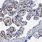 Immunohistochemical staining of human placenta shows strong cytoplasmic and nuclear positivity in endothelial cells.