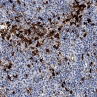 Immunohistochemical staining of human lymph node shows strong cytoplasmic and nuclear positivity in non-germinal center cells.