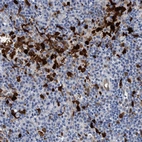 Immunohistochemical staining of human lymph node shows strong cytoplasmic and nuclear positivity in non-germinal center cells.