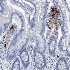 Immunohistochemical staining of human small intestine shows strong cytoplasmic and nuclear positivity in a subset of leukocytes.