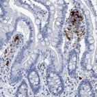 Immunohistochemical staining of human small intestine shows strong cytoplasmic and nuclear positivity in a subset of leukocytes.
